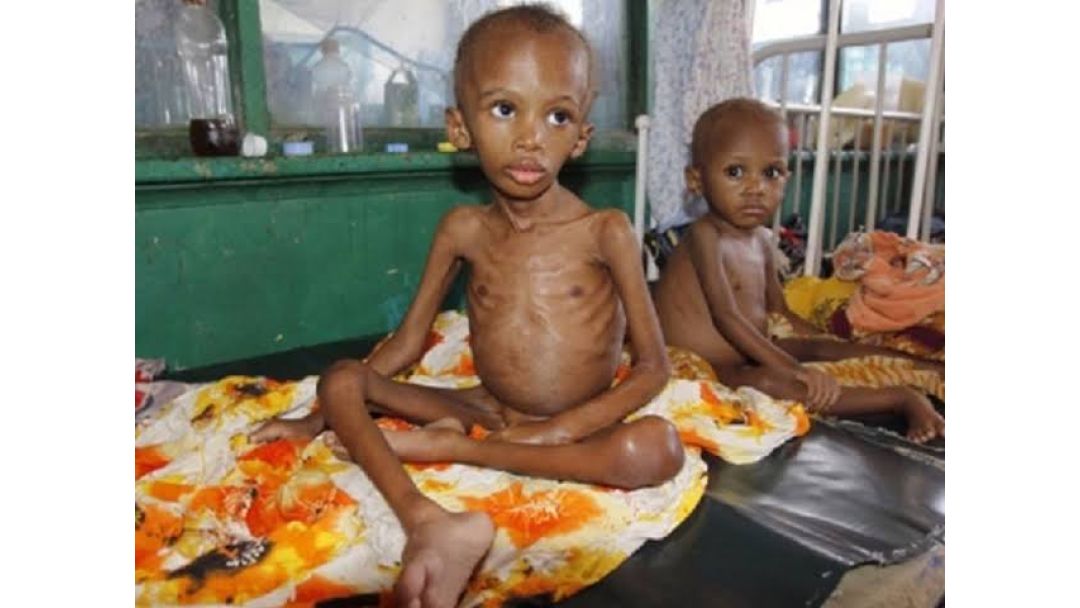 Ọrị ọmụrụ nwa: Nsogbu ụkọ nri na Naịjirịa chọrọ mmegharị ngwa ngwa